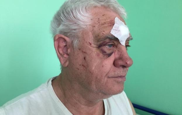 В Харькове коп избил пенсионера за просьбу уступить место в трамвае – СМИ