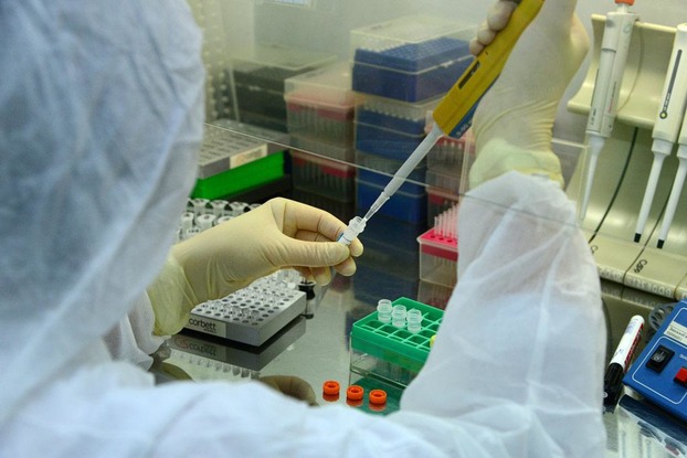 В Украине число лабораторно подтвержденных случаев COVID-19 увеличилось до 2 777