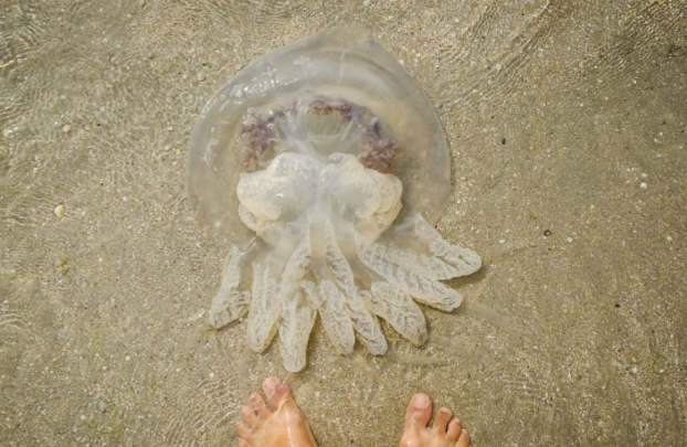 Ребенок получил ожог лица после контакта с медузой в Азовском море