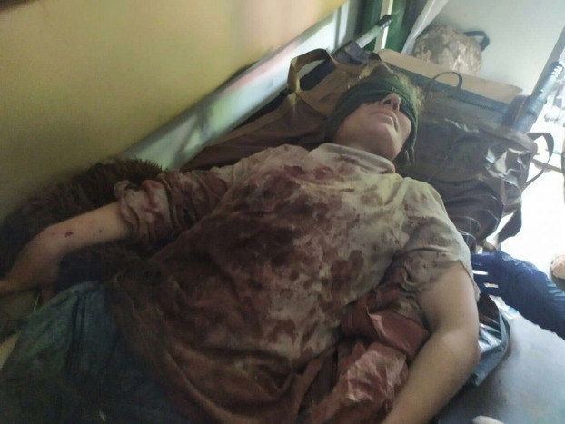 На Донбассе на мине подорвалась жительница Авдеевки