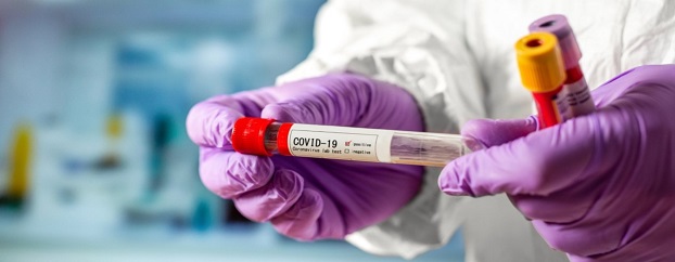 Сколько на самом деле должен стоить тест на коронавирус в Украине