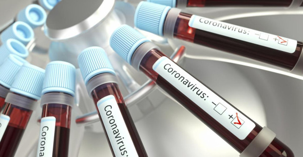 В Константиновской ОТГ 19 человек заразились коронавирусом