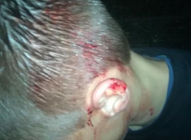 В Мирнограде собаки бойцовской породы напали на юношу. Фото