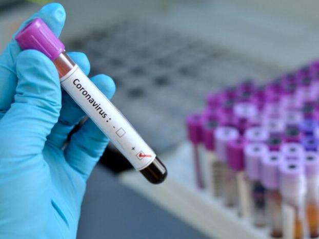 Украина получит экспресс-тесты для выявления коронавируса