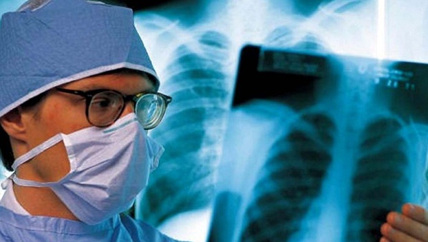В МОЗ рассказали об  уровне смертности от туберкулеза