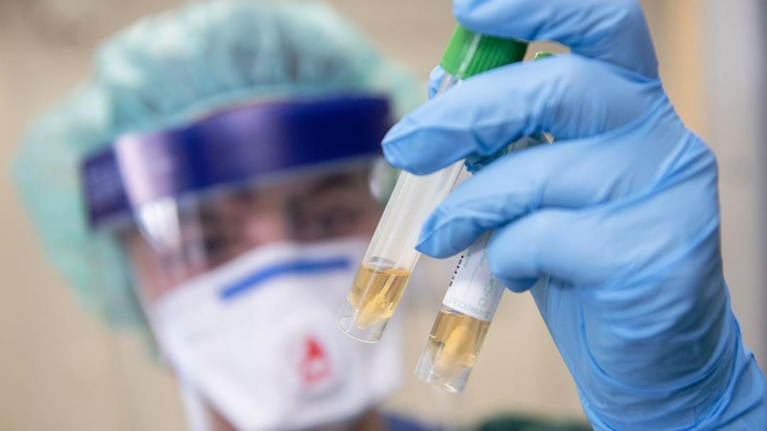 Клинические испытания проходят 3 вакцины от коронавируса