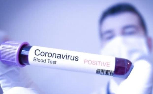 Распространение коронавируса в Украине лишь вопрос времени - эксперт