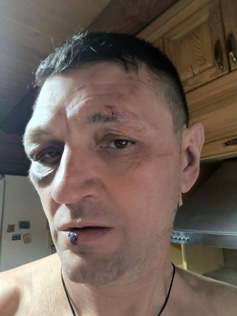 Вадим Рудюк, травмы
