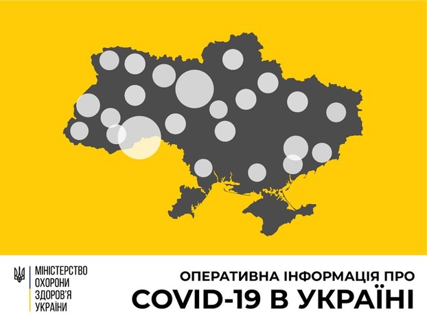В Украине число лабораторно подтвержденных случаев COVID-19 увеличилось 1251