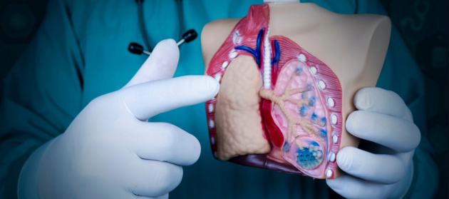 Как ухаживать за внутривенным портом Как ухаживать за внутривенным портом