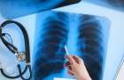 В Доброполье начинается эпидемия туберкулеза 