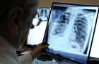 17 сентября в Краматорске врачи ответят на вопросы по туберкулезу