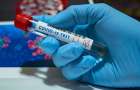 В Дружковке 58 человек ожидают результатов тестирования на коронавирус