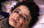 Химическая атака в Сирии: Жертвы среди детей и женщин