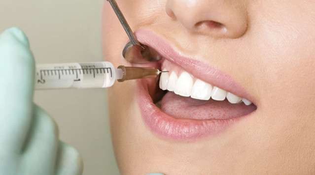 Больно ли ставить импланты зубов: особенности анестезии при имплантации