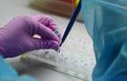 На Донетчине 17 человек госпитализированы с подозрением на коронавирус