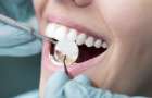 Берегите зубы: В Константиновке закрыли стоматологию