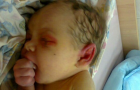 В детскую городскую больницу Славянска попал 8-месячный ребенок в тяжелом состоянии