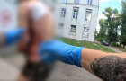 Раненого во время обстрела Торецка мужчину госпитализировали в Константиновку. Видео