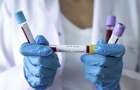В Мариуполе 22 человека выздоровели от коронавируса